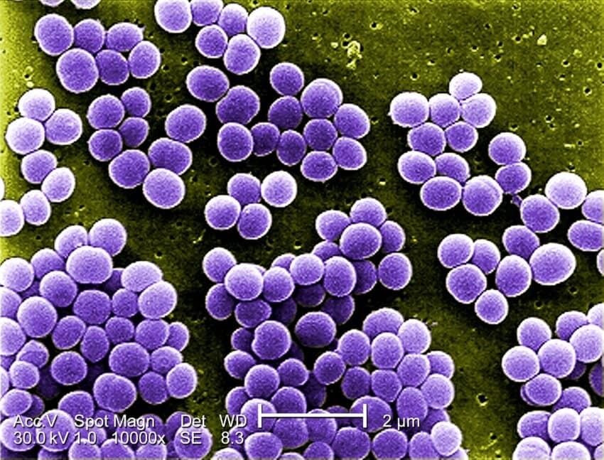 Staphylococcus_Aureus